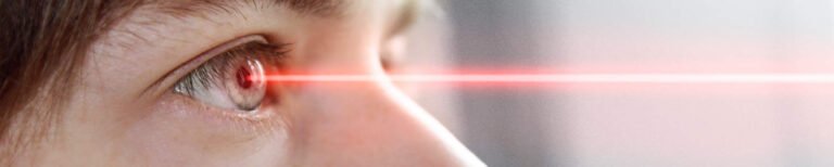 cirurgia refrativa laser curitiba2